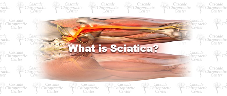 What is Sciatica?