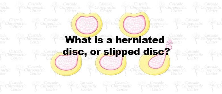 What is a herniated disc, or slipped disc?